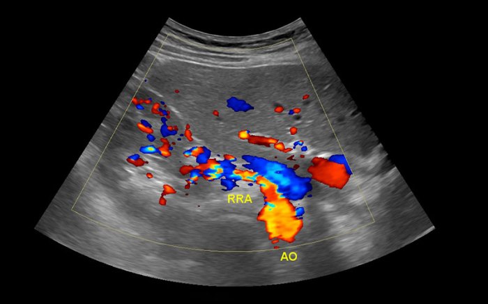 Cpt ct codes head neck exams austin imaging association brain body radiological lung screening tissue soft